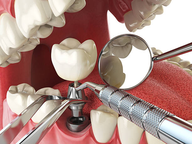 Best Broken or Cracked Tooth Emergency Dentist in Fort Belknap Agency, MT